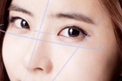 盐城做完开内眼角手术之后不能做哪些事？