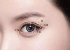 盐城内眦赘皮矫正术的目的