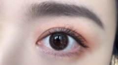 盐城眼部整形知多少