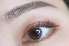 盐城开眼角双眼皮价格