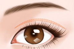 什么方法防止眼角下垂有效?
