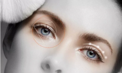 盐城上眼睑凹陷怎么办