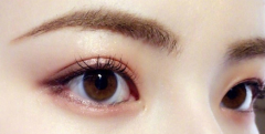 眼部整形的术前准备